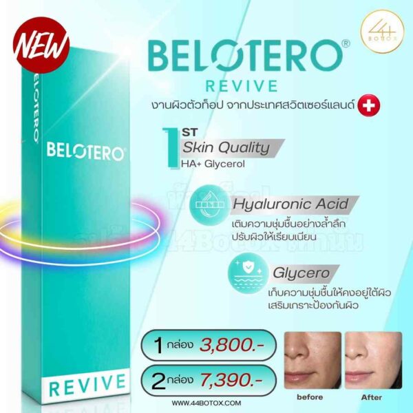 Belotero revive