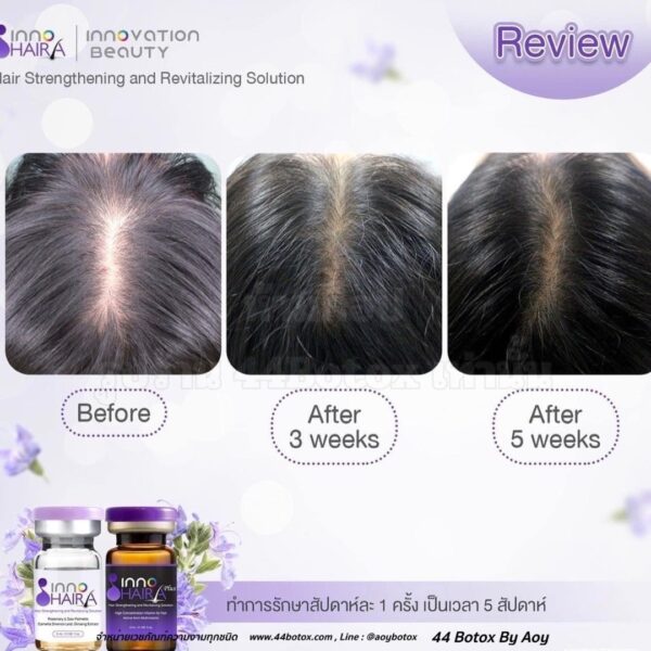 INNO HAIRA ลดผมร่วงได้ดั่งใจกับผู้ช่วยสุดคุณภาพ เร่งผมขึ้นไวกว่าเดิม - Image 3
