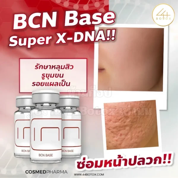 BCN Base Super X-DNA
