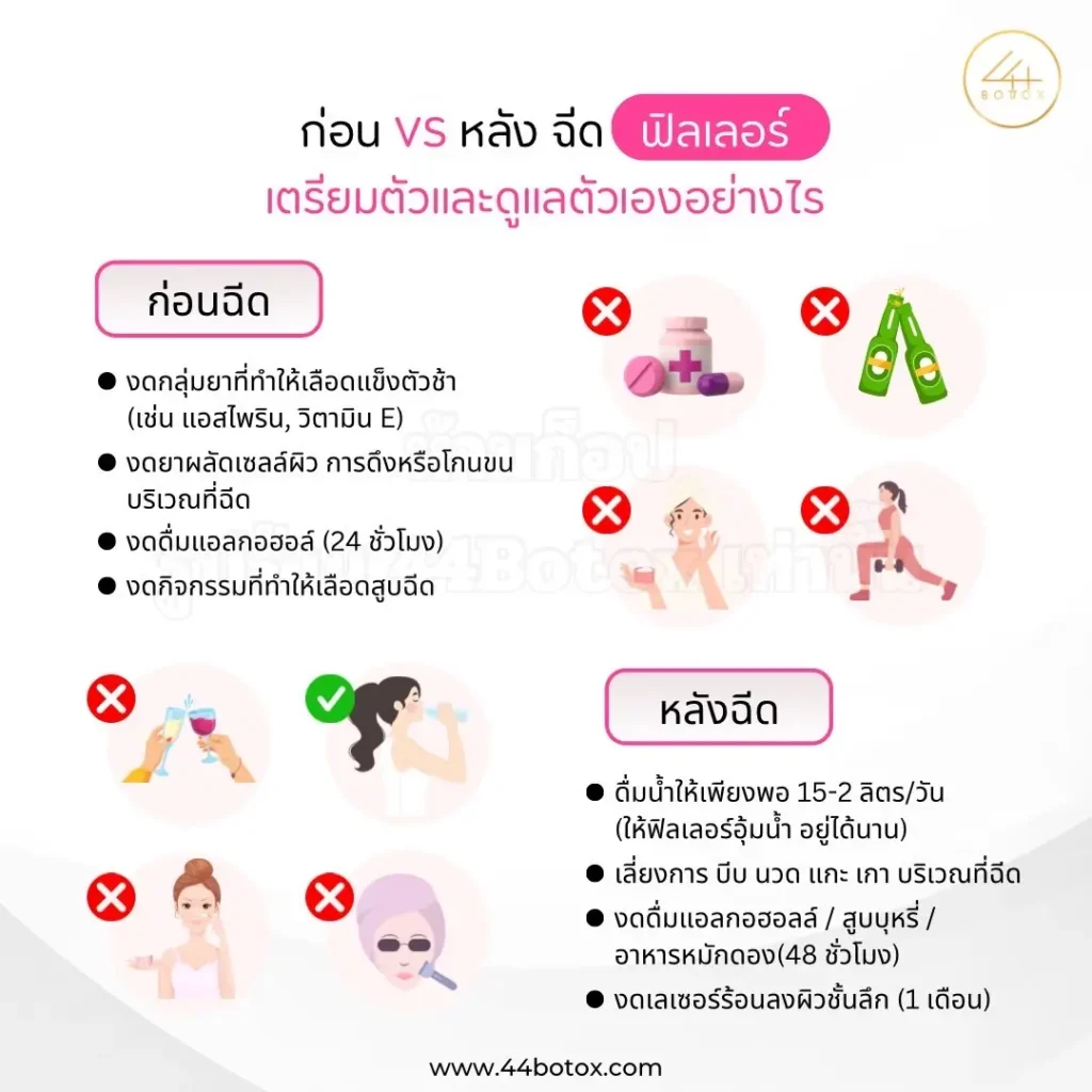 หลังฉีดฟิลเลอร์
