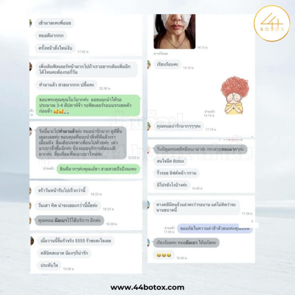 44 botox รีวิว