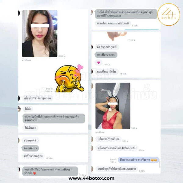 44 botox รีวิว