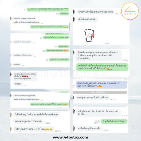 44 botox รีวิว
