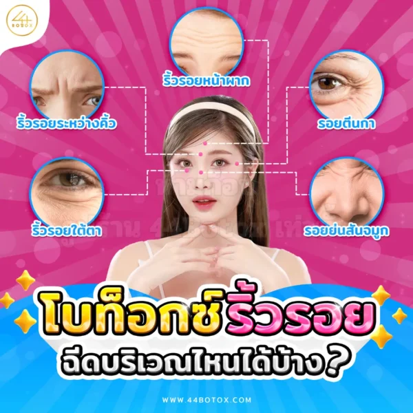 ฉีดโบลดริ้วรอย