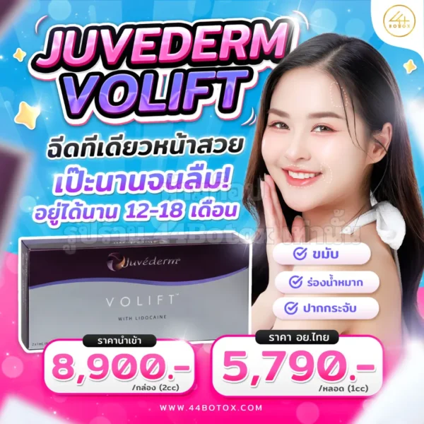 Juvederm volift
