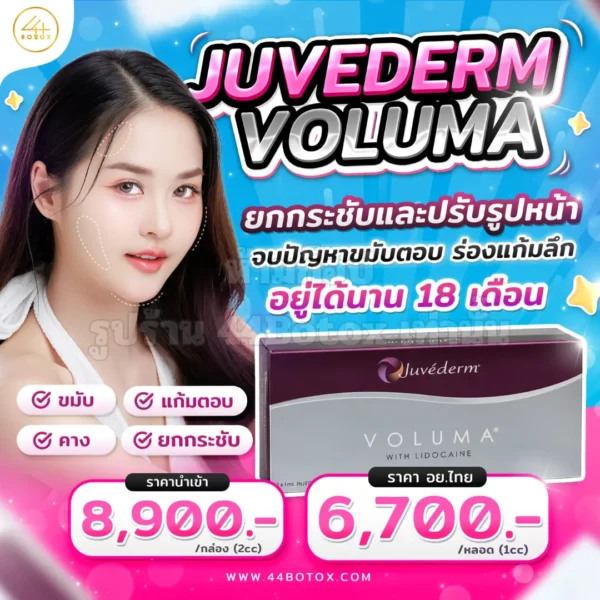 Juvederm voluma